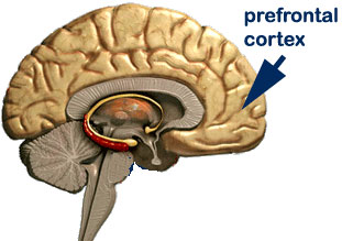 IQ-prefrontal